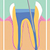 Better Alternatives to Silver Fillings