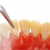 Are You Afraid of the Dentist?