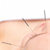 Dental Pain? Try Acupuncture